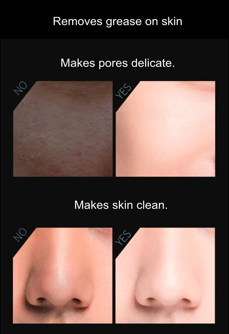 PureMatte™ Volcanic Oil Control Roller
Instant Shine Reduction